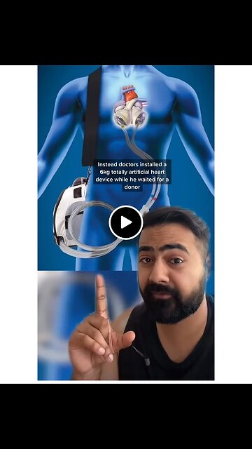 LIVED WITHOUT HEART🤯🤯 MUST WATCH, MAKE SURE YOU FOLLOW ME ON RUMBLE FOR MORE!!!