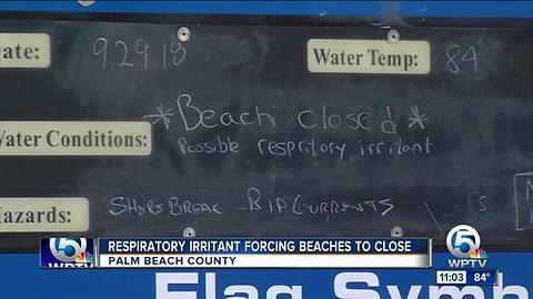 Respiratory irritant forcing beaches to close