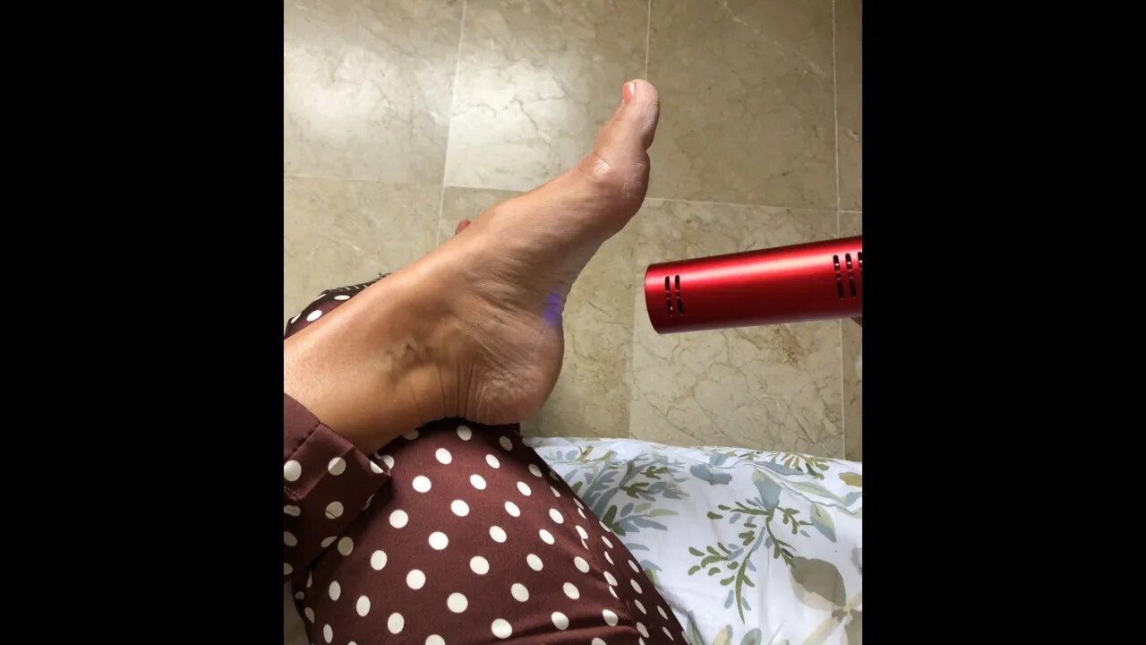 Min hælspore er næsten væk! 💥🥰👏🏼💪🏼