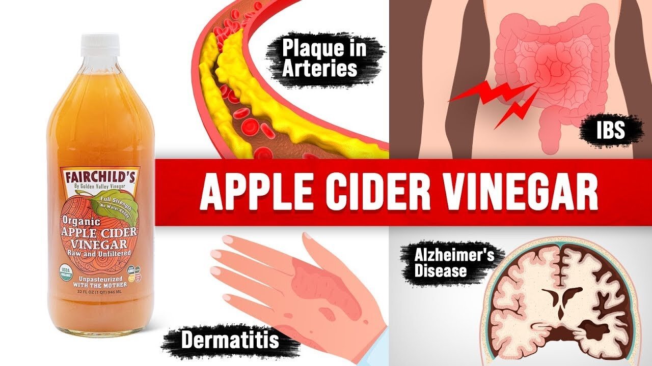 9 Unexpected Amazing Benefits of Apple Cider Vinegar (ACV)