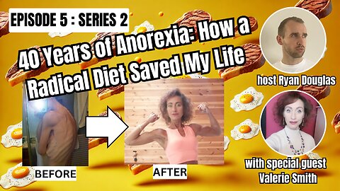 40 Years of Anorexia: How a Radical Diet Saved My Life With Valerie Smith