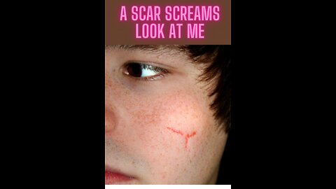 A Scar Screams Look At Me