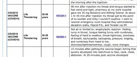 Covid Vaccine Severe Reactions