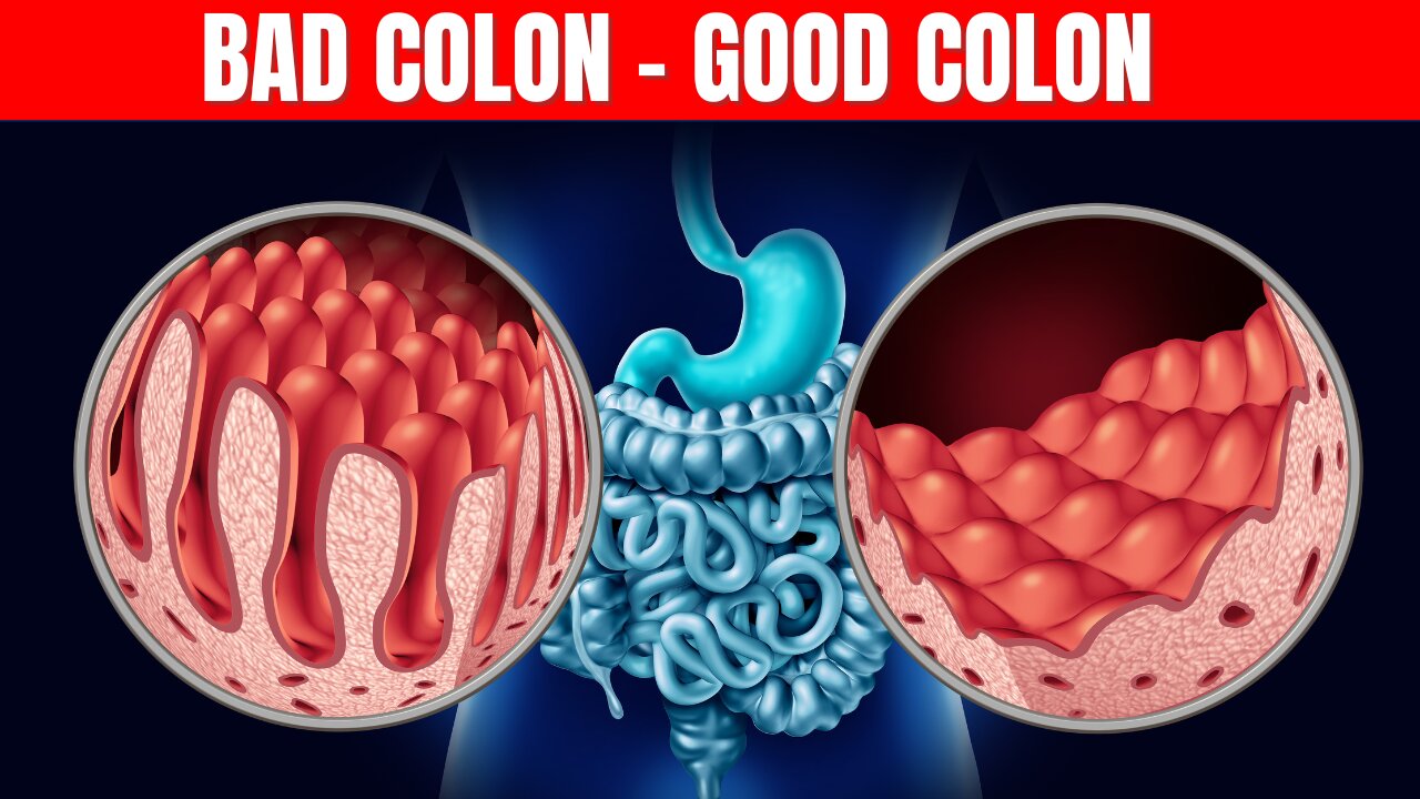 Best Foods To Help Unclog Your Colon