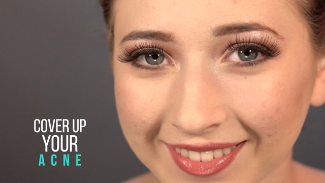 Cover up your acne
