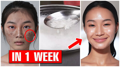 The Korean Rice Water Routine for Smooth, Acne-Free Skin _ Earthluxe