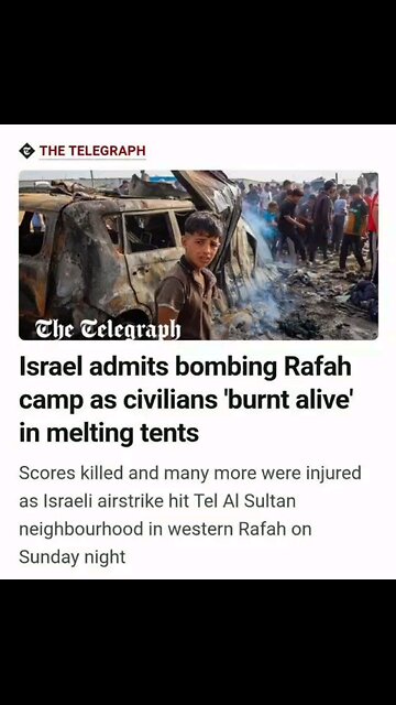 GAZA PALESTINE “Burnt alive in melting tents” CHILDREN. Never forget. Never forgive.