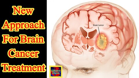 Brain cancer Hundreds of children could benefit from new approach to treatment