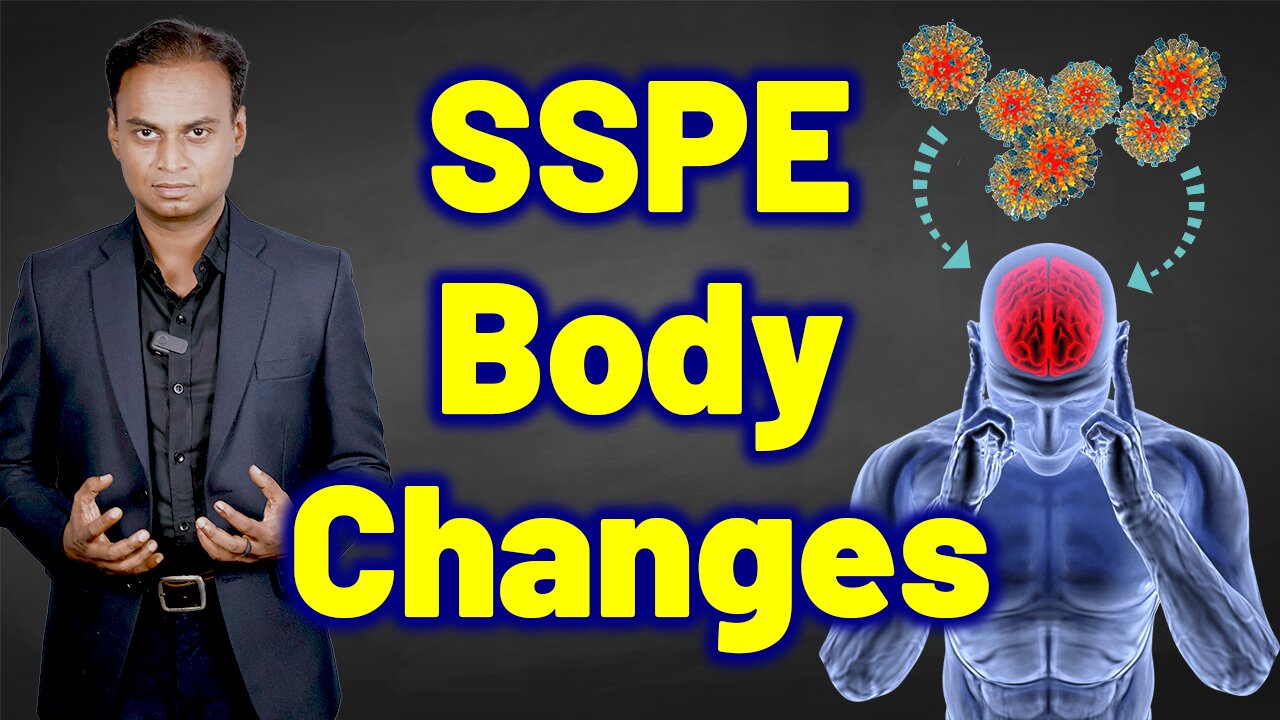 Changes in the body due to SSPE, Subacute Sclerosing Panencephalitis | Rare Treatment Cure Relief