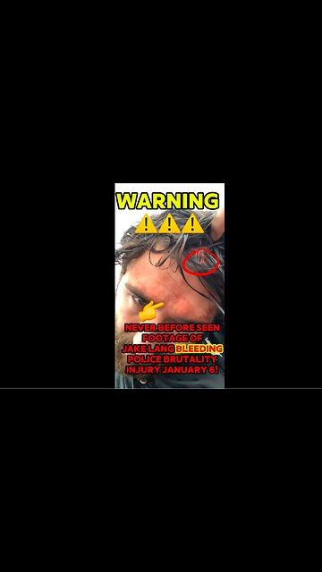 WARNING ⚠️⚠️⚠️ NEVER BEFORE SEEN video of Jake Lang at the Capitol BLEEDING