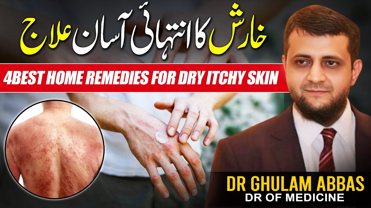 Treatment of itching