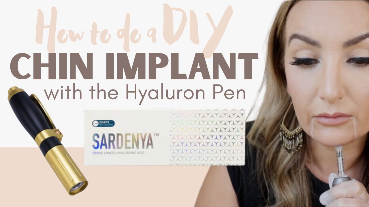 Chin Filler w/ the Hyaluron Pen