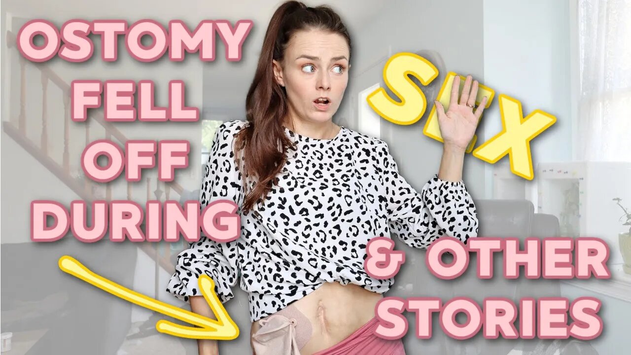 My Ostomy Fell Off During... & More Embarrassing Chronic Illness Moments | Let's Talk IBD