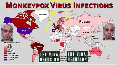 The WHO's Non Existing MPOX (MonkeyPox) 'Virus' Countries Begin Locking Down!