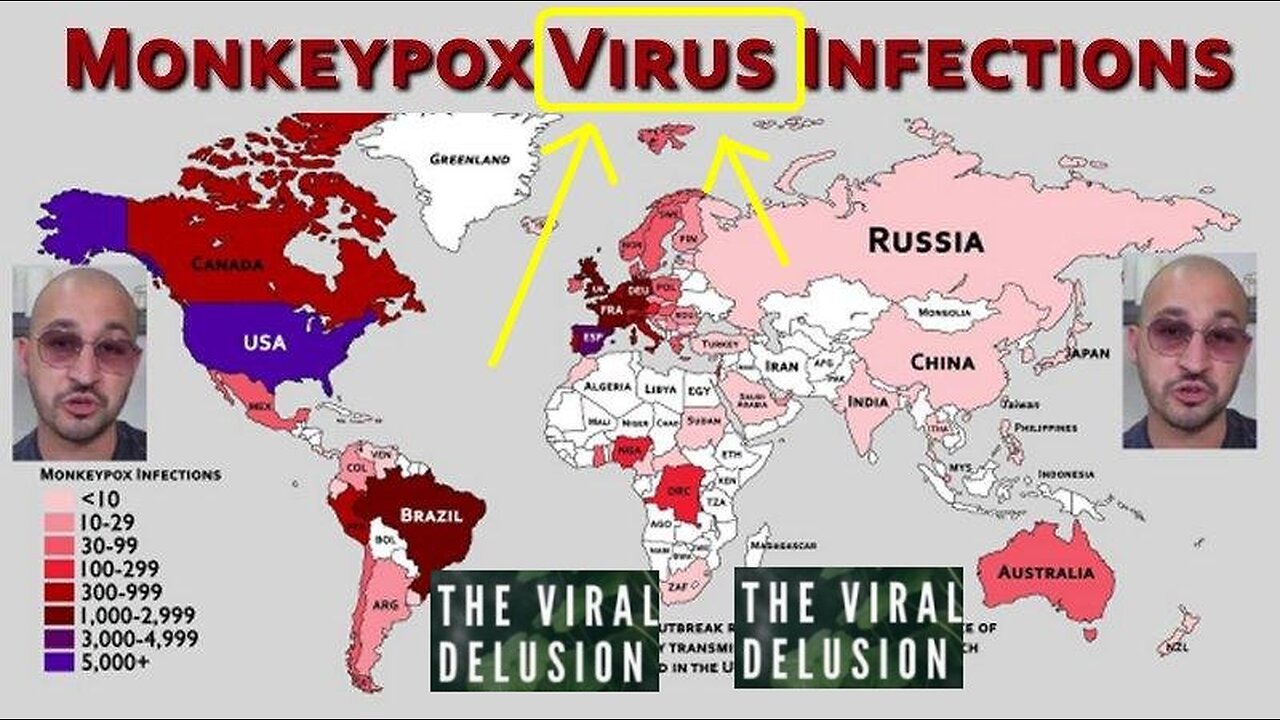 The WHO's Non Existing MPOX (MonkeyPox) 'Virus' Countries Begin Locking Down!