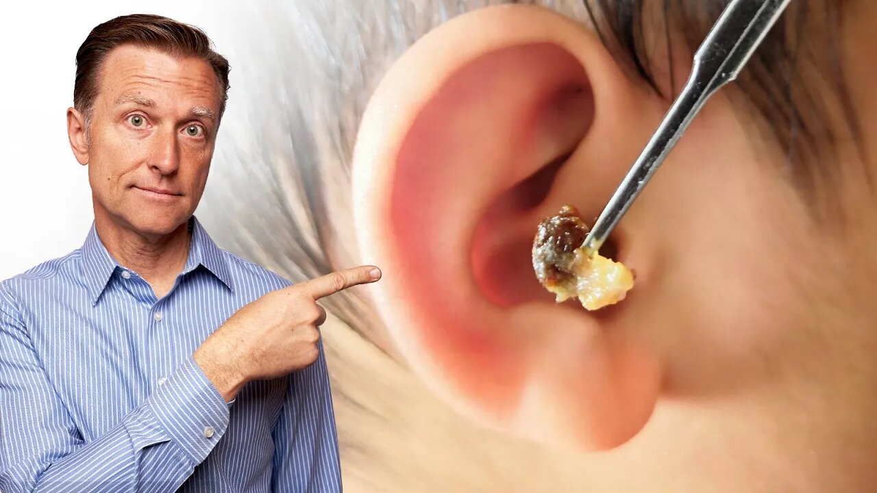 What Does LOTS of EARWAX Buildup Mean?