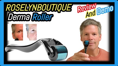 ROSELYNBOUTIQUE Derma Roller Review And How To Use It