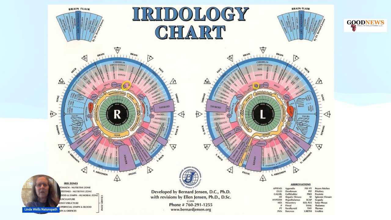 Part 5 Iridology, Pineal Decalcification, Fruit vs. Vegetables