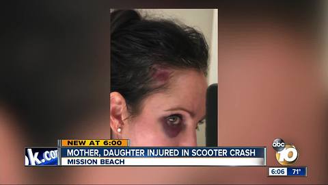 Mom, daughter injured in motorized scooter crash