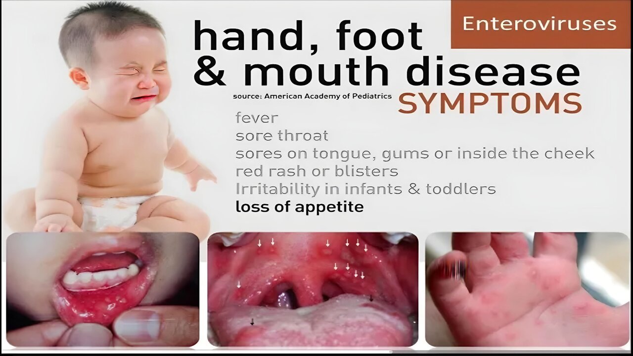 Lessons Learnt: 20th anniversary of Enterovirus A71 Epidemic of 1998 in Taiwan (Video 1, 2 & 3) (Sound A.I. Remastered)