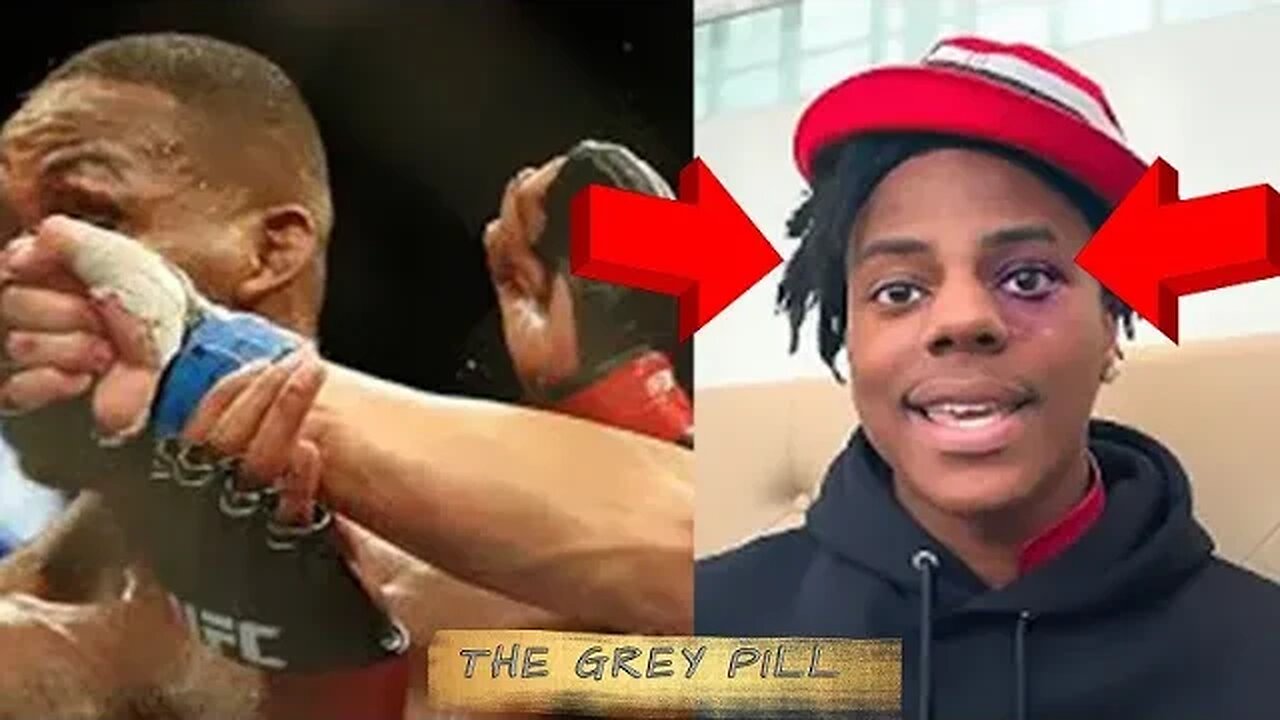 Youtuber Speedy Got Punched In The Face!!