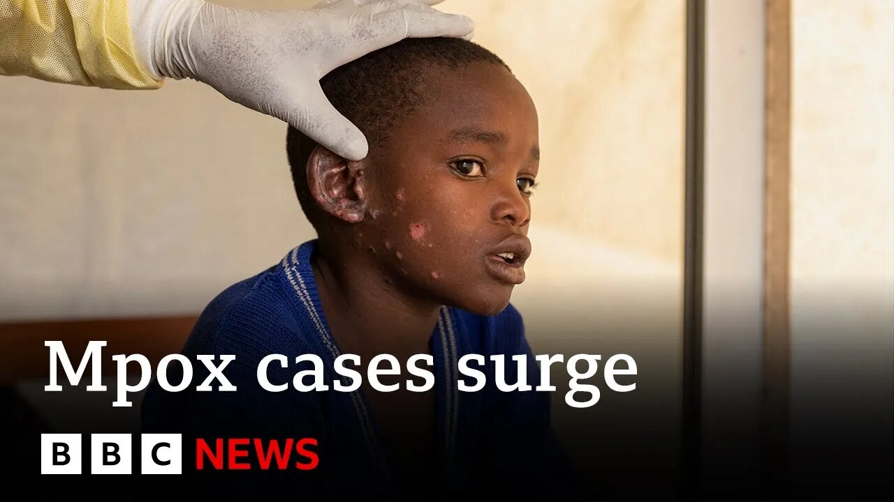 Mpox Vaccine Rollout Begins in Congo Amid Rising Cases in East & Central Africa