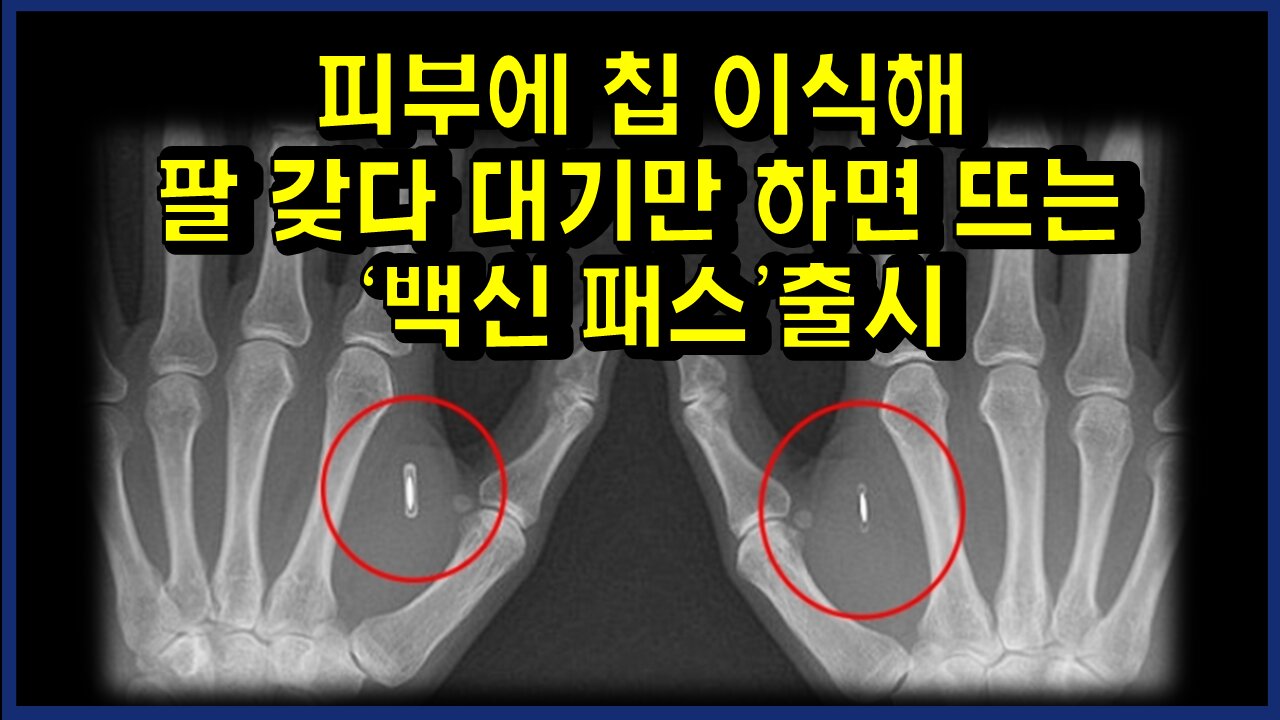 [#324] 피부에 칩 이식해 팔 갖다 대기만 하면 뜨는 '백신 패스’출시