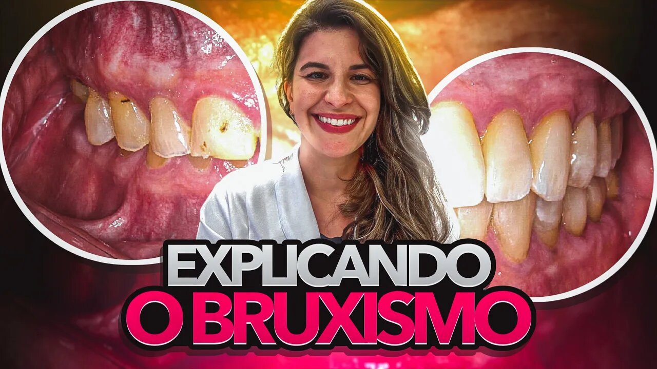 Bruxismo - Tipos e Tratamento do Bruxismo