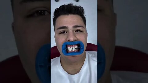 Putin mai diferit #oguritamica #mancaciosul #mancare #food