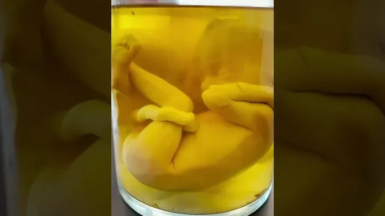 Amazing REAL Human Fetus That Taught Millions | #shorts