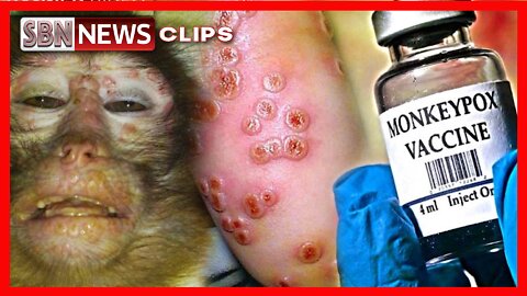 REPORT: HOW MONKEYPOX WAS PLANNED FOR PANDEMIC [#6248]