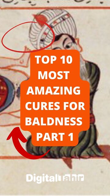 Top 10 Most Amazing Cures For Baldness Part 1