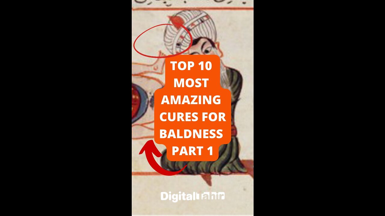 Top 10 Most Amazing Cures For Baldness Part 1