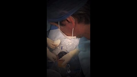 c section baby born