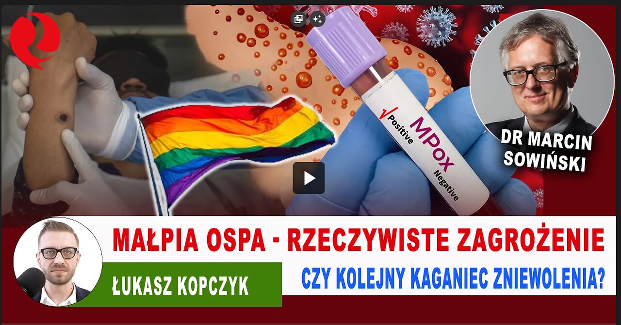 Małpia ospa - rzeczywiste zagrożenie czy kolejny kaganiec zniewolenia? lek. Marcin Sowiński