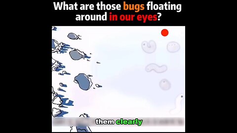 What are those bugs floating around in our eyes?