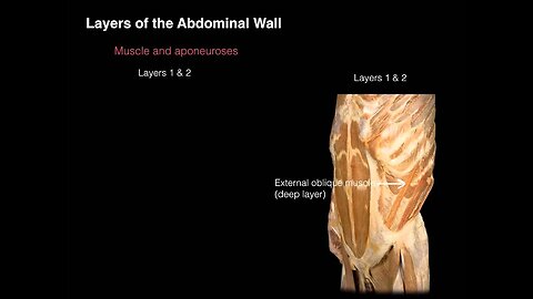 Ant Abdominal Wall Anterior view