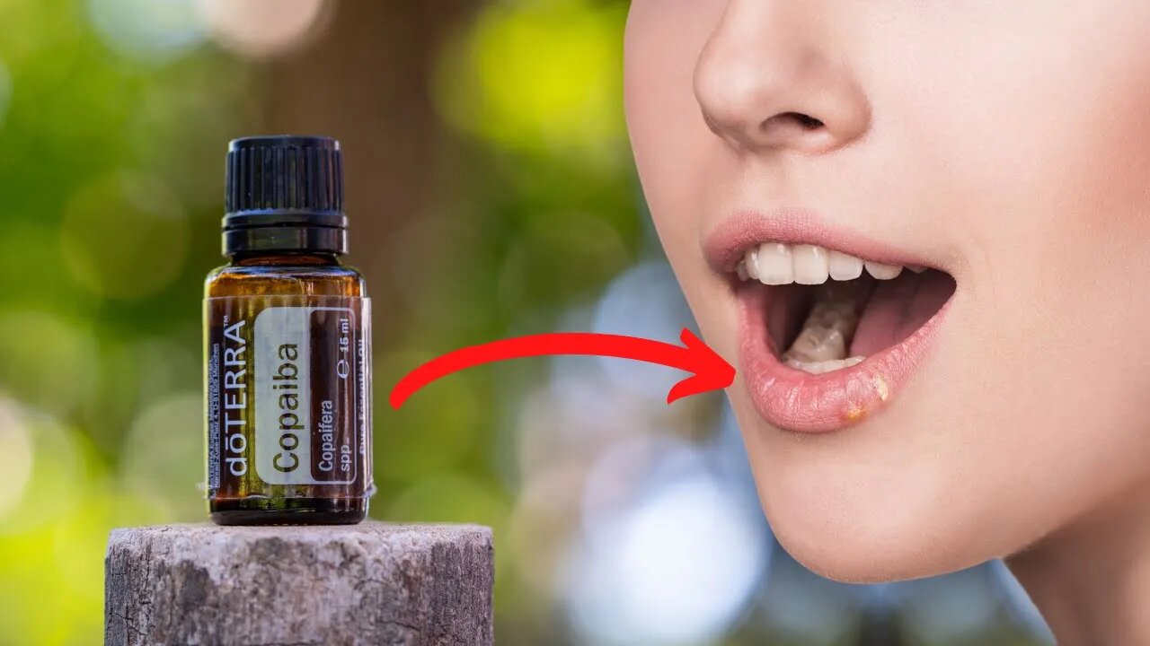 Copaiba: Powerful Remedy for Herpes, Eczema, Syphilis, and Even Stroke