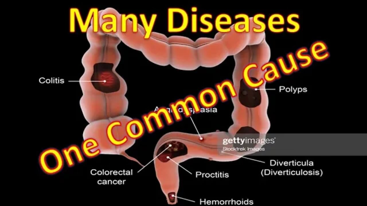 Chapter 2 - What is the common cause of diseases in the colon?