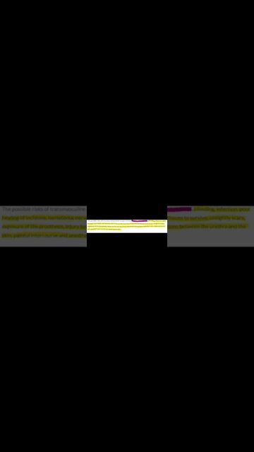 You're gonna regret it