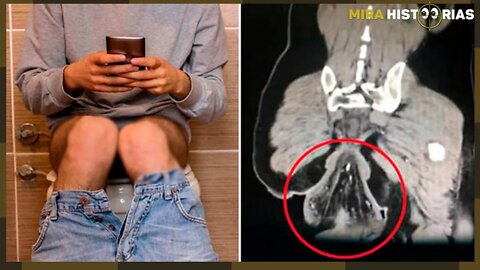 Homem tem o reto expelido para fora após ficar no banheiro jogando no celular