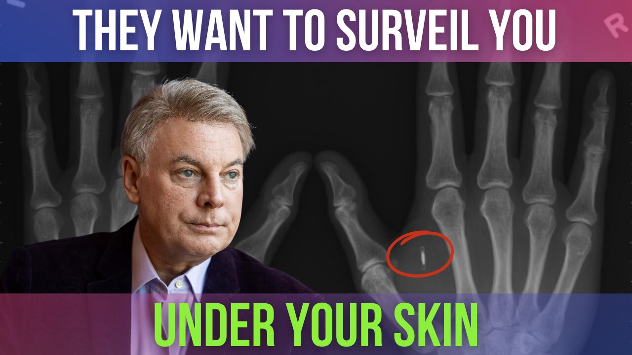 They Want to Surveil You Under Your Skin | Lance Wallnau