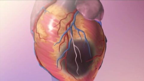 Researchers receive $18 million grant to address cardiovascular health in underserved communities