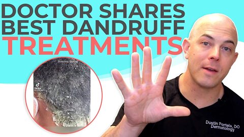 How to Treat Dandruff | 208SkinDoc