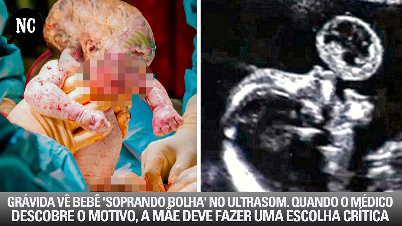 Grávida Vê filha 'Soprando Bolha' No Ultrassom. Quando O Médico Descobre O Motivo, A Mãe Deve...