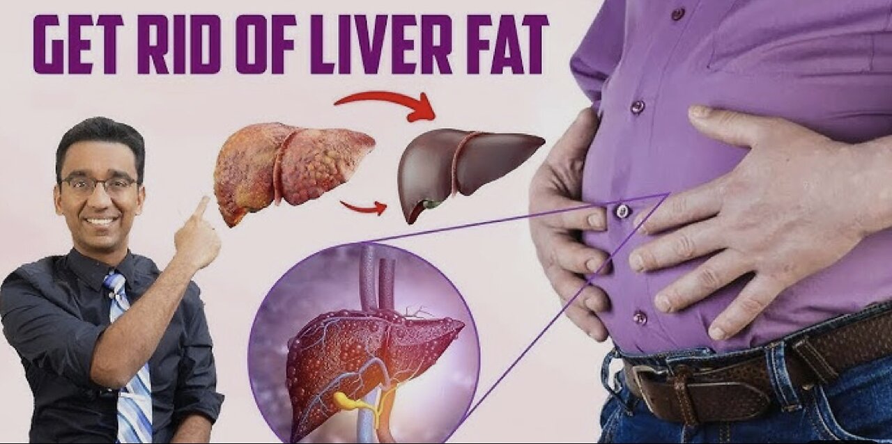 How to DETOX your FATTY liver without medications? | Dr Pal