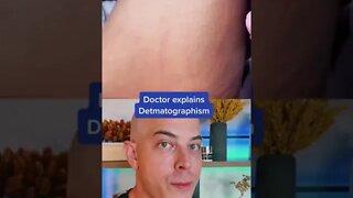 Crazy skin reaction!