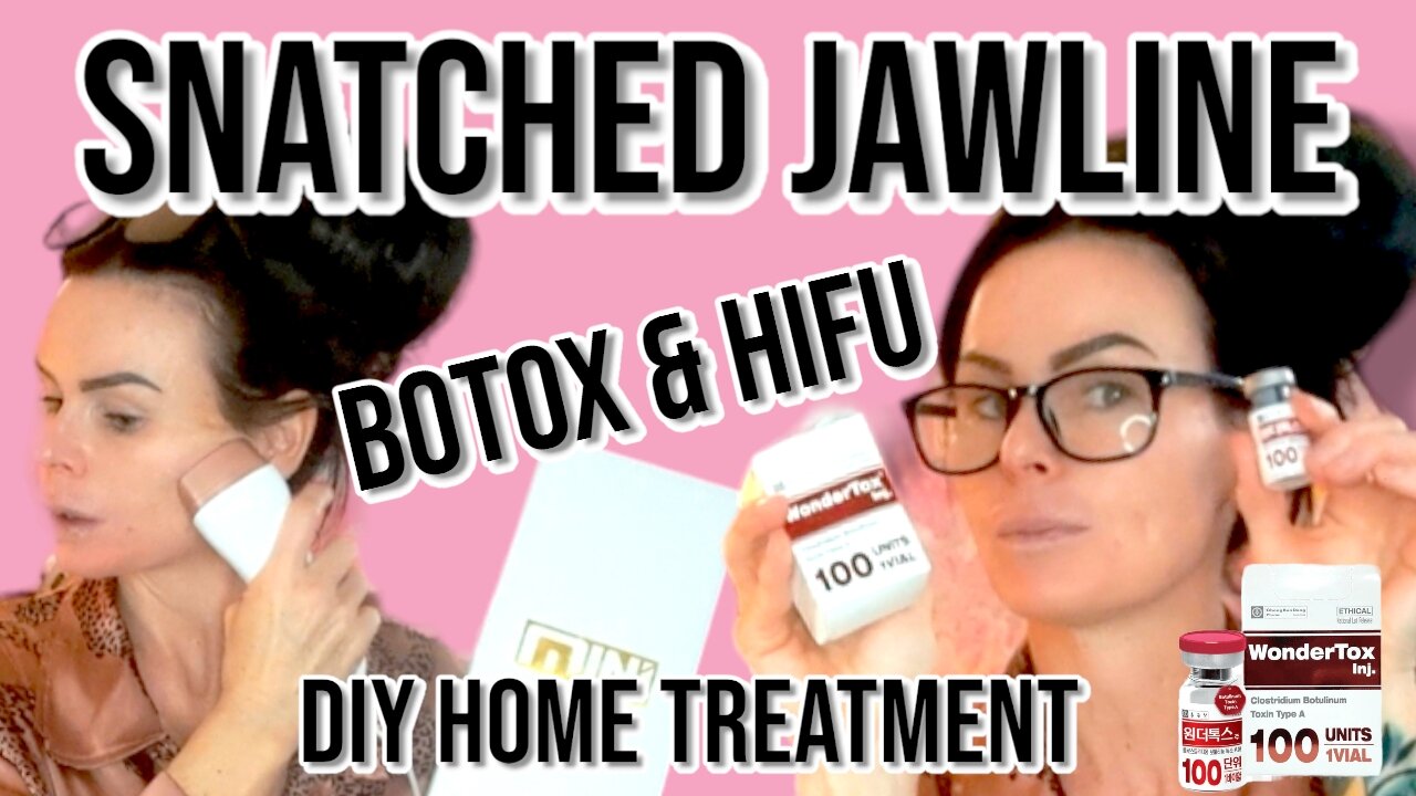 Snatched Jawline Botox HIFU / GlamCosm Discount Code ( Holly10 )