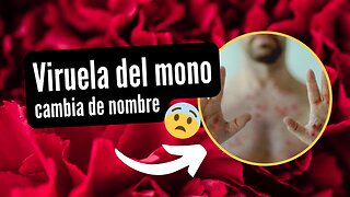 La viruela del Mono cambia de nombre