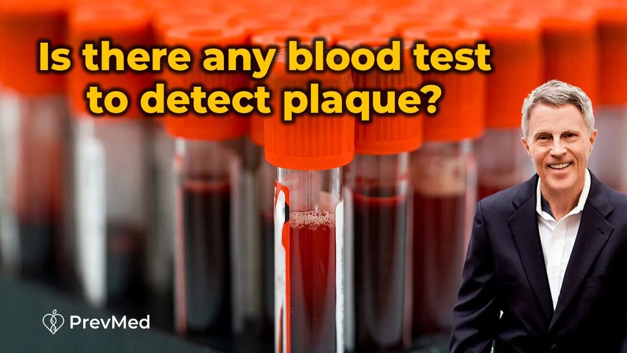 Is there any Blood Test to Detect Plaque?